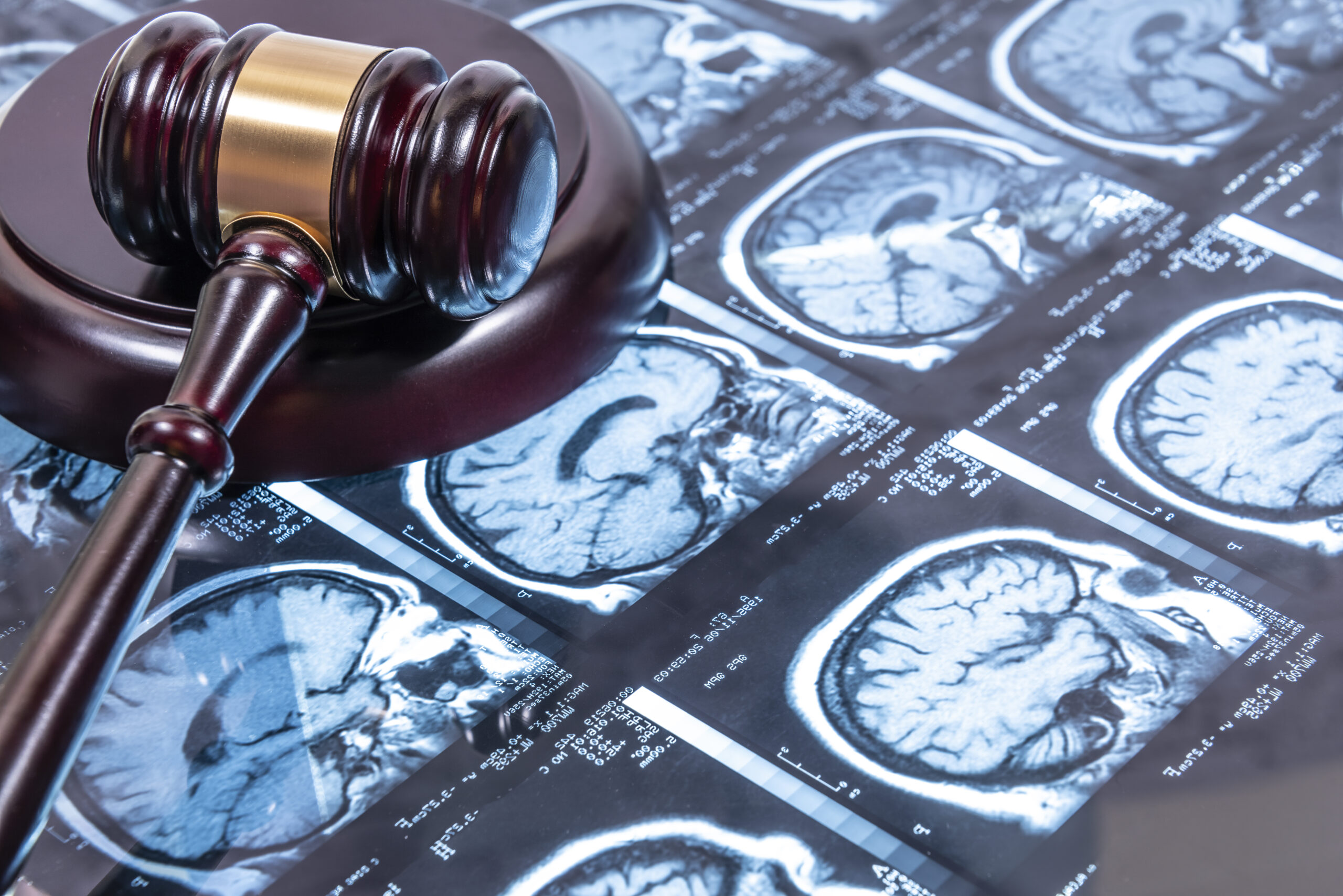 Valparaiso Brain Injury Attorneys